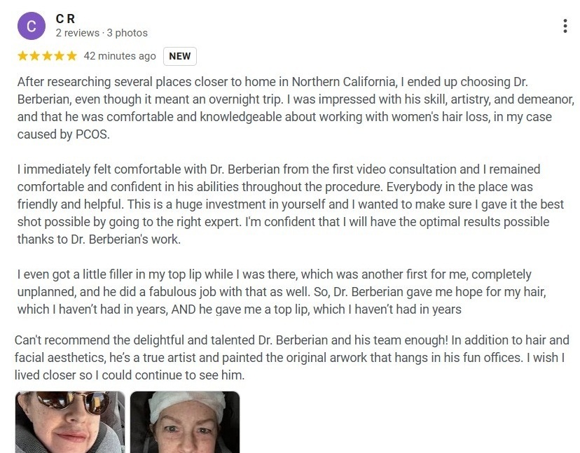 Dr. Rob Berberian VIP FUE Hair Transplant Los Angeles & Newport Beach Reviews